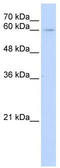 Interleukin 22 Receptor Subunit Alpha 1 antibody, TA338470, Origene, Western Blot image 