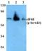 Eukaryotic Translation Initiation Factor 4B antibody, A00846S422, Boster Biological Technology, Western Blot image 