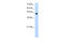 Transcription Factor AP-2 Epsilon antibody, 29-175, ProSci, Western Blot image 