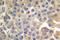 FYN Proto-Oncogene, Src Family Tyrosine Kinase antibody, LS-C177902, Lifespan Biosciences, Immunohistochemistry paraffin image 
