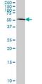 MDM2 Proto-Oncogene antibody, H00004193-M01, Novus Biologicals, Western Blot image 