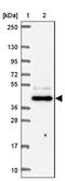 Farnesyltransferase, CAAX Box, Beta antibody, NBP2-38002, Novus Biologicals, Western Blot image 