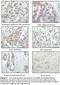 Ribosomal Protein S6 Kinase A1 antibody, LS-C47225, Lifespan Biosciences, Immunohistochemistry frozen image 