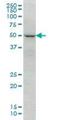 Forkhead Box C2 antibody, H00002303-M02, Novus Biologicals, Western Blot image 