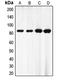 Enhancer Of Zeste 1 Polycomb Repressive Complex 2 Subunit antibody, MBS822210, MyBioSource, Western Blot image 