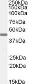 Apolipoprotein B MRNA Editing Enzyme Catalytic Subunit 3G antibody, LS-B3951, Lifespan Biosciences, Western Blot image 