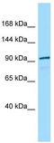 Terminal Uridylyl Transferase 1, U6 SnRNA-Specific antibody, TA345367, Origene, Western Blot image 