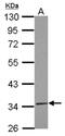 TruB Pseudouridine Synthase Family Member 2 antibody, NBP2-20740, Novus Biologicals, Western Blot image 