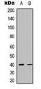 C-X-C Motif Chemokine Receptor 4 antibody, LS-B13299, Lifespan Biosciences, Western Blot image 