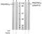 Protein Kinase D1 antibody, GTX78965, GeneTex, Western Blot image 