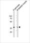 B4GT7 antibody, PA5-49418, Invitrogen Antibodies, Western Blot image 