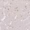 ABR Activator Of RhoGEF And GTPase antibody, PA5-63028, Invitrogen Antibodies, Immunohistochemistry frozen image 