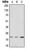 Mediator Complex Subunit 22 antibody, LS-C353780, Lifespan Biosciences, Western Blot image 
