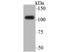 Bromodomain Containing 2 antibody, A02412, Boster Biological Technology, Western Blot image 