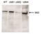 Lysine Methyltransferase 2B antibody, CI1100, Boster Biological Technology, Western Blot image 