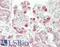 BCL2L2-PABPN1 Readthrough antibody, LS-B13239, Lifespan Biosciences, Immunohistochemistry paraffin image 