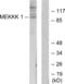 Mitogen-Activated Protein Kinase Kinase Kinase Kinase 1 antibody, abx013738, Abbexa, Western Blot image 