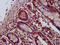 SNF2 Histone Linker PHD RING Helicase antibody, LS-C673001, Lifespan Biosciences, Immunohistochemistry paraffin image 