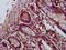 E3 ubiquitin-protein ligase SHPRH antibody, LS-C673001, Lifespan Biosciences, Immunohistochemistry paraffin image 