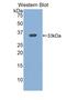 Integrin Subunit Beta 3 antibody, MBS2026479, MyBioSource, Western Blot image 