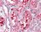 Glucosaminyl (N-Acetyl) Transferase 3, Mucin Type antibody, 51-265, ProSci, Immunohistochemistry frozen image 