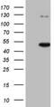 Cyclin Dependent Kinase Like 1 antibody, NBP2-46217, Novus Biologicals, Western Blot image 