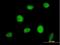 Ring Finger Protein 144A antibody, H00009781-B02P, Novus Biologicals, Immunocytochemistry image 