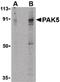 P21 (RAC1) Activated Kinase 5 antibody, PA5-20232, Invitrogen Antibodies, Western Blot image 