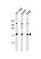 N(Alpha)-Acetyltransferase 50, NatE Catalytic Subunit antibody, 61-775, ProSci, Western Blot image 