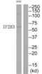Insulin Like Growth Factor 2 MRNA Binding Protein 3 antibody, abx013268, Abbexa, Western Blot image 