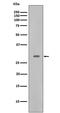 Cyclin Dependent Kinase 5 antibody, M00511, Boster Biological Technology, Western Blot image 