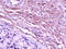 Collagen Type I Alpha 1 Chain antibody, 251221, Abbiotec, Immunohistochemistry paraffin image 