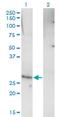 Rhox Homeobox Family Member 1 antibody, H00158800-M01, Novus Biologicals, Western Blot image 