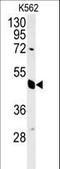 Eukaryotic Translation Initiation Factor 3 Subunit G antibody, LS-C167690, Lifespan Biosciences, Western Blot image 