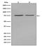 Alkaline Phosphatase, Biomineralization Associated antibody, M01008-1, Boster Biological Technology, Western Blot image 