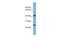 Fetuin B antibody, PA5-42165, Invitrogen Antibodies, Western Blot image 