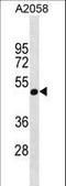 G Protein Subunit Alpha 11 antibody, LS-C157778, Lifespan Biosciences, Western Blot image 