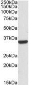 Calponin 2 antibody, NBP1-36741, Novus Biologicals, Western Blot image 