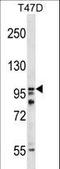 HPS3 Biogenesis Of Lysosomal Organelles Complex 2 Subunit 1 antibody, LS-C165006, Lifespan Biosciences, Western Blot image 