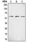 Major Histocompatibility Complex, Class I, A antibody, orb340829, Biorbyt, Western Blot image 