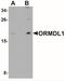 ORMDL Sphingolipid Biosynthesis Regulator 1 antibody, NBP1-76577, Novus Biologicals, Western Blot image 