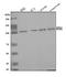 Adaptor Related Protein Complex 2 Subunit Alpha 1 antibody, A08806-1, Boster Biological Technology, Western Blot image 