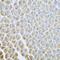 Adaptor Related Protein Complex 1 Subunit Mu 2 antibody, GTX33012, GeneTex, Immunohistochemistry paraffin image 