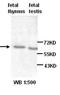 Autoimmune regulator antibody, orb77028, Biorbyt, Western Blot image 