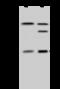 Proteasome Inhibitor Subunit 1 antibody, GTX02338, GeneTex, Western Blot image 