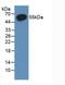 Estrogen Receptor 2 antibody, abx130999, Abbexa, Western Blot image 