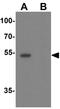 Sestrin-2 antibody, GTX31602, GeneTex, Western Blot image 