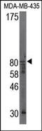 Calpain 9 antibody, 200196, Abbiotec, Western Blot image 