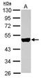 Keratin 33B antibody, NBP2-19310, Novus Biologicals, Western Blot image 