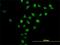 Cyclin And CBS Domain Divalent Metal Cation Transport Mediator 3 antibody, H00026505-B01P, Novus Biologicals, Immunofluorescence image 